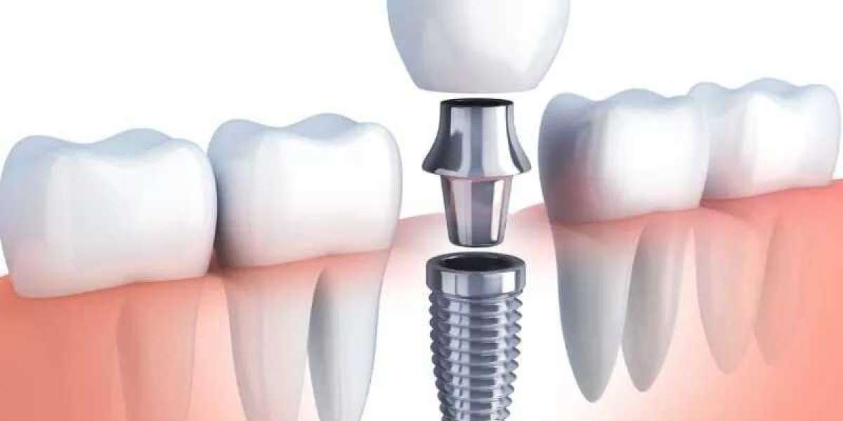 Oral Surgery Services in McKinney Tx